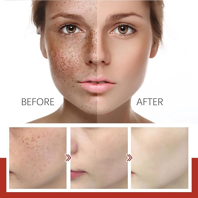 Eelhoe Dark Spot & Pigment Correcting Cream