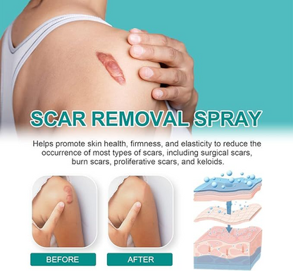 Medical Scar Care Removal Spray